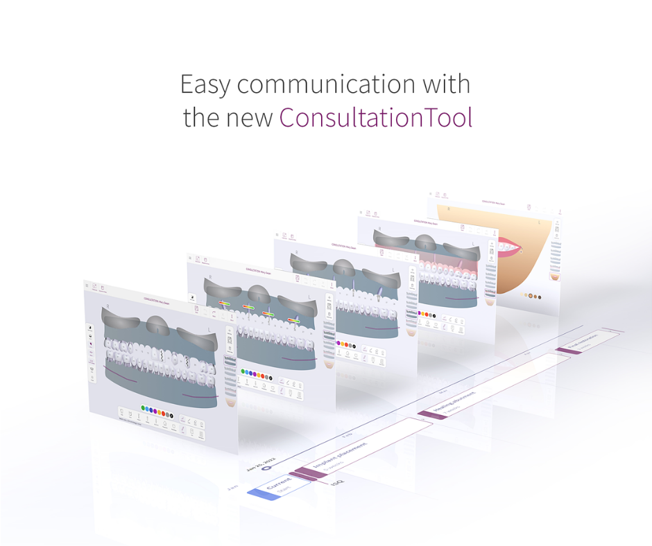 Osstell presents the new ConsultationTool