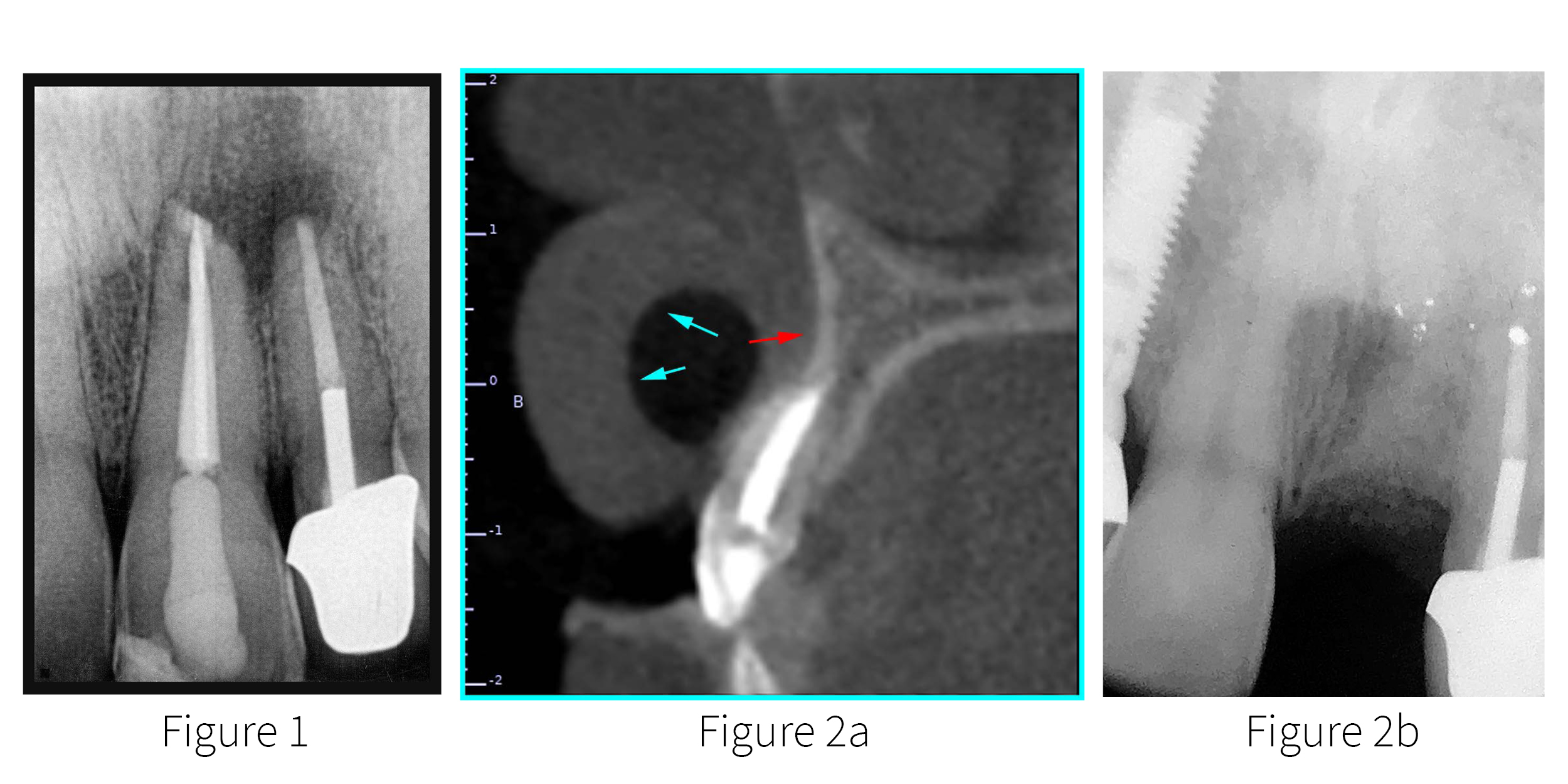 Fig 1 - 2ab