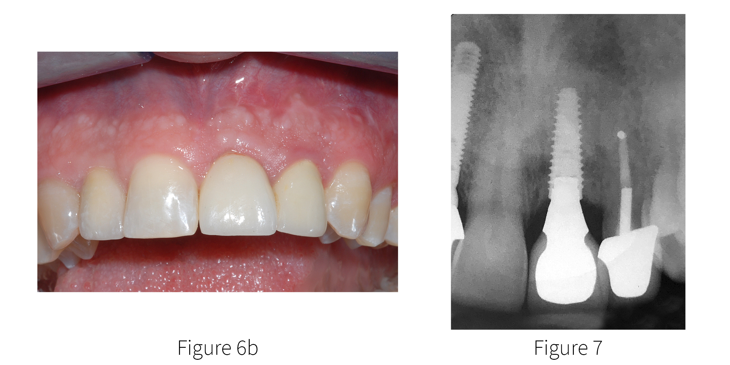 Fig 6b-7