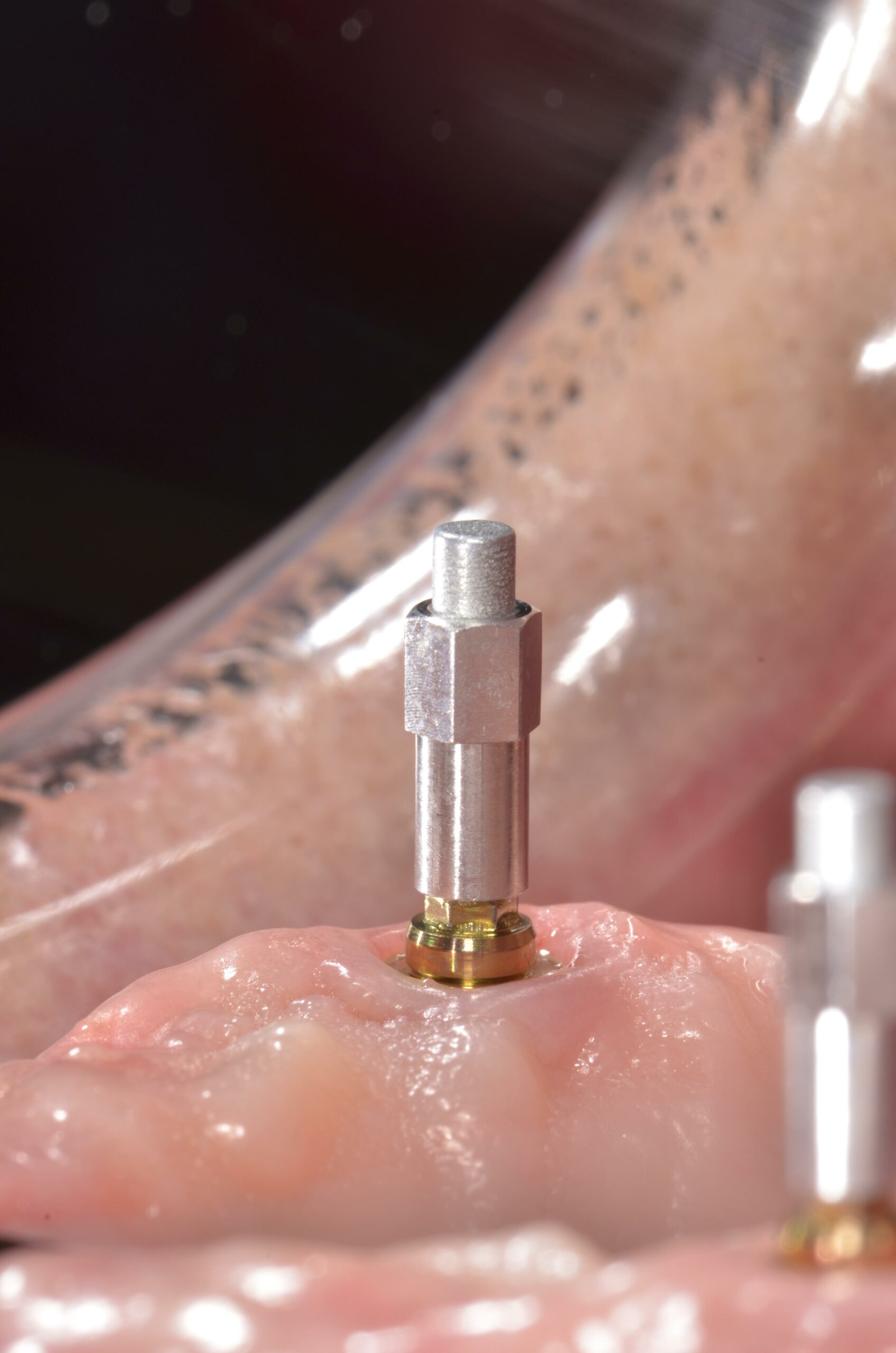 Measuring Osstell ISQ on abutment 3