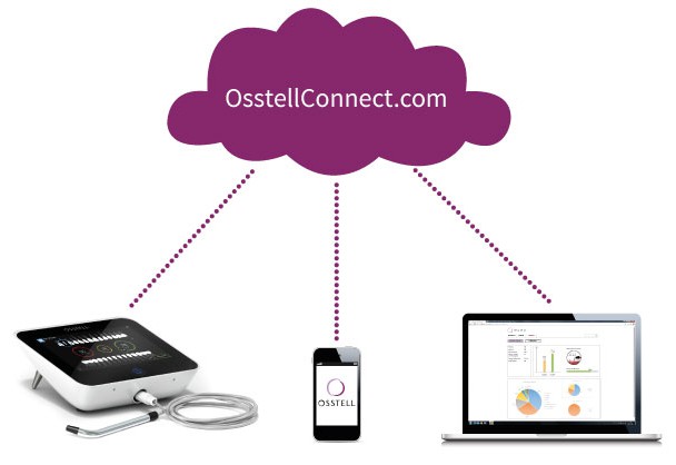 Osstell Connect