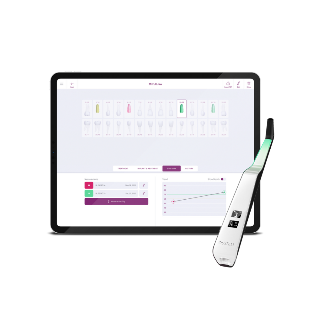thumbnail image 2 of Dental Osstell Beacon ISQ Implant Stability Meter – Monitor Osseointegration, FDA K181691 2 of 5