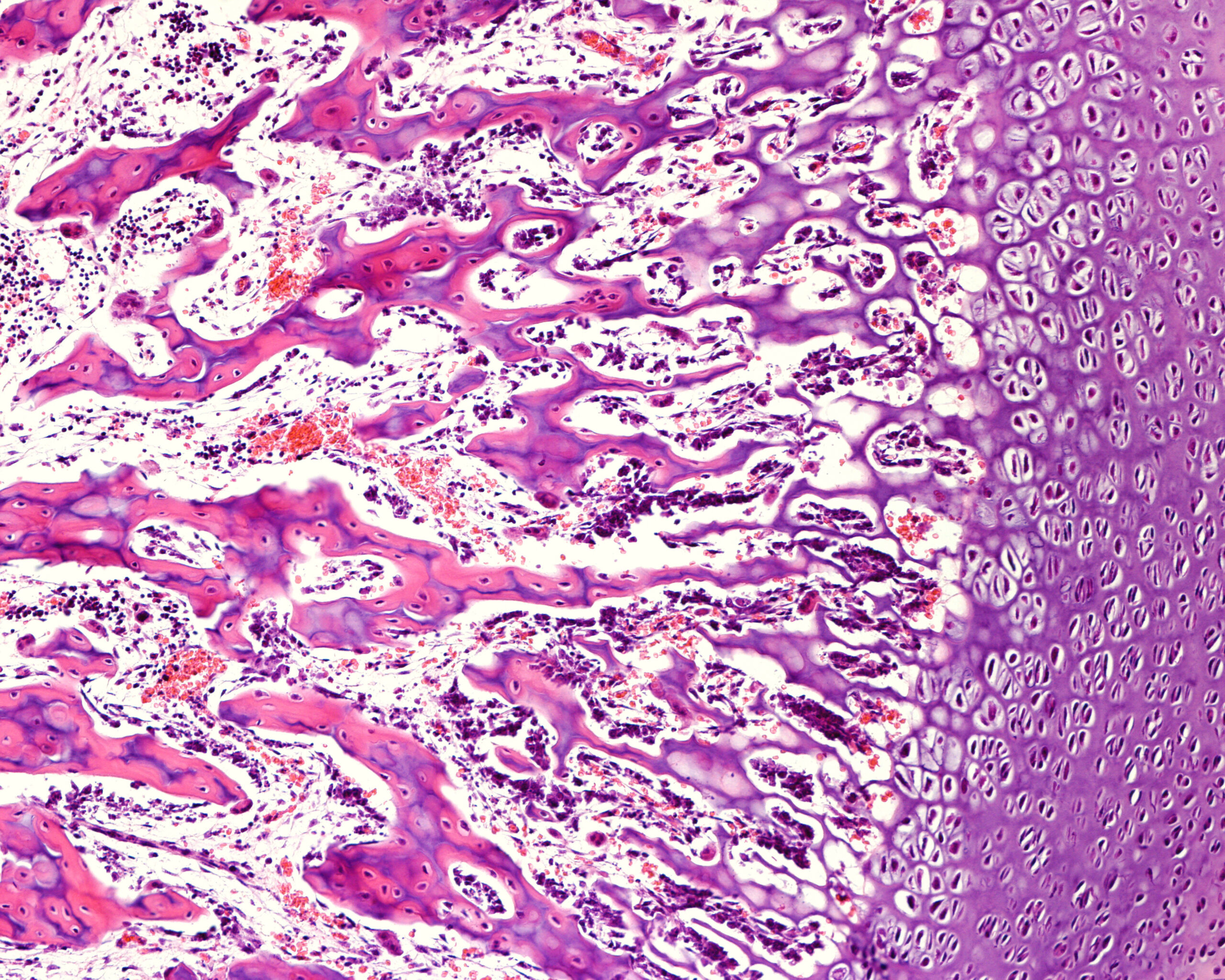 understandingosseointegrationindentistry image